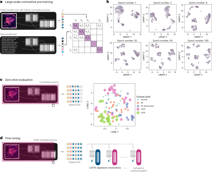 A generalizable deep learning system for cardiac MRI